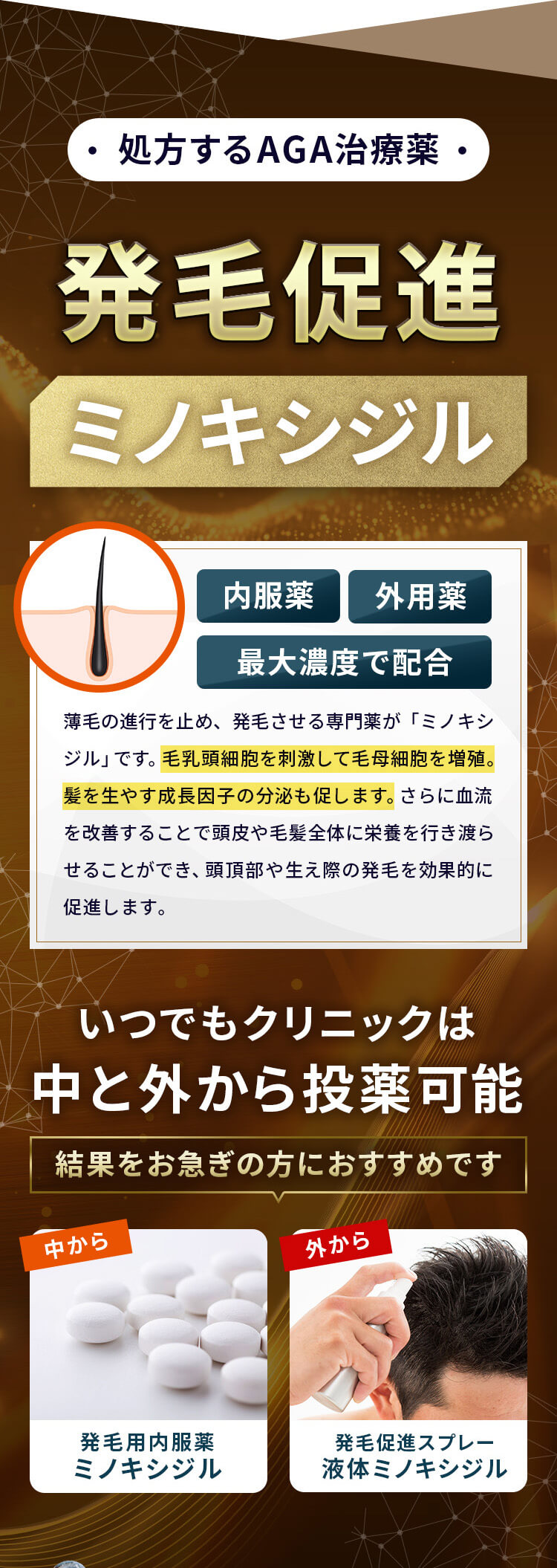 処方するAGA治療薬　発毛促進ミノキシジル